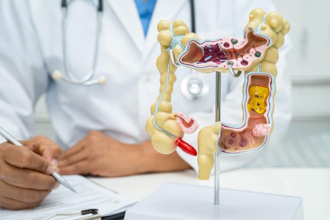 appendix-treatment