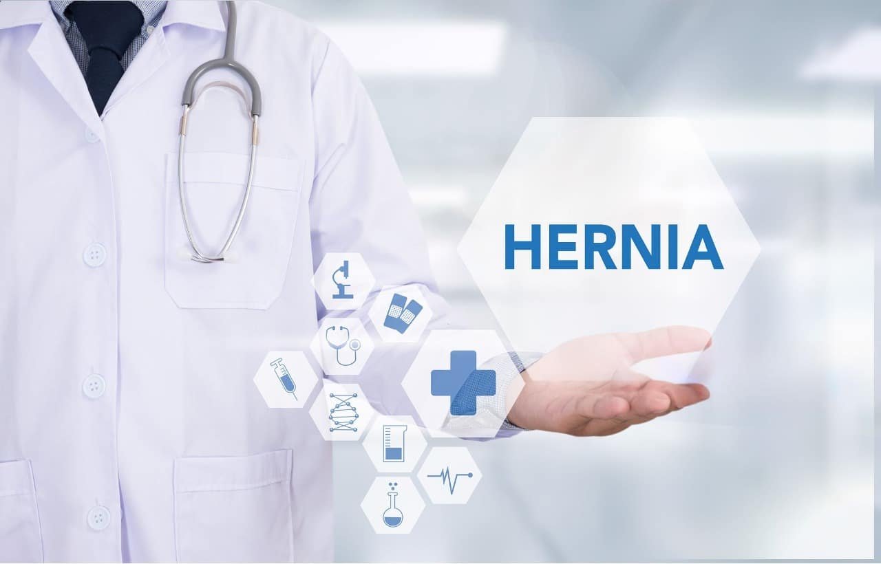hernia-treatment