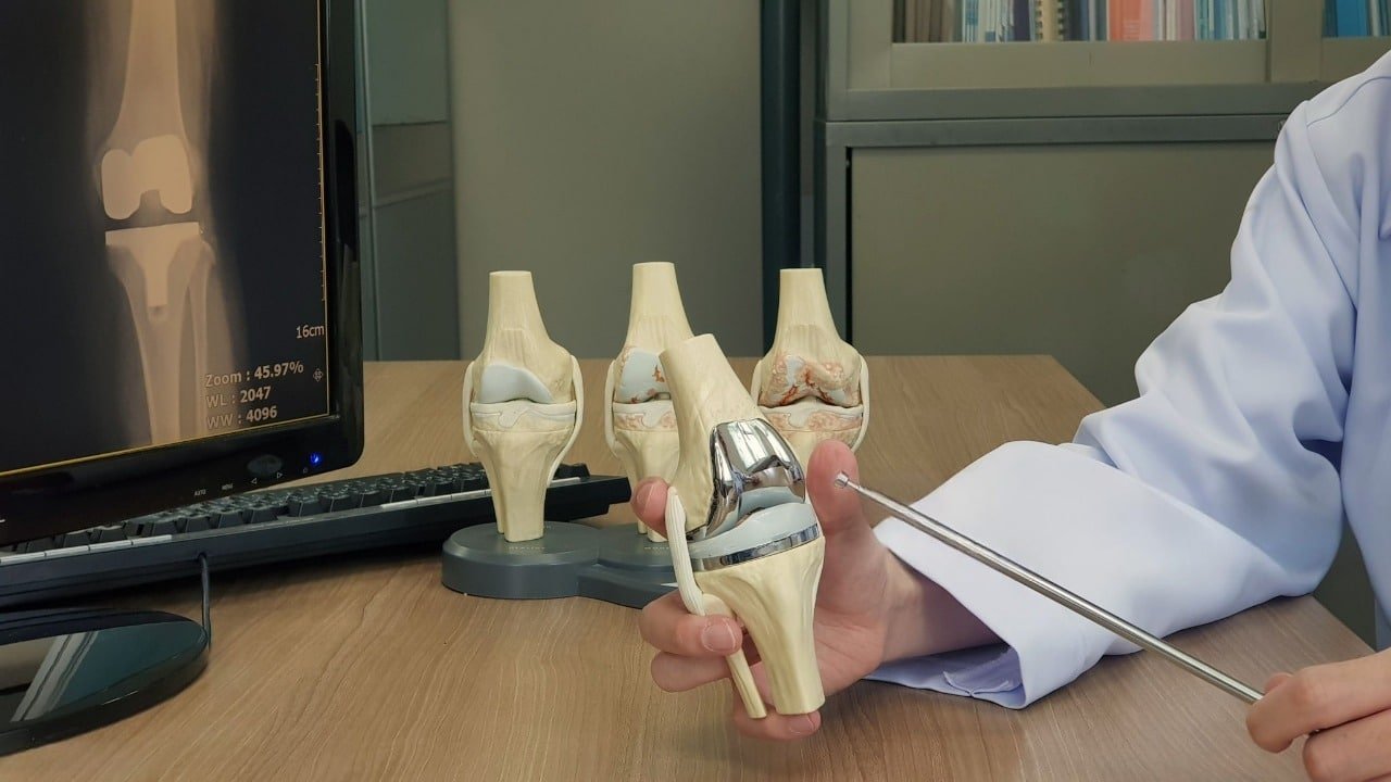 knee-replacement
