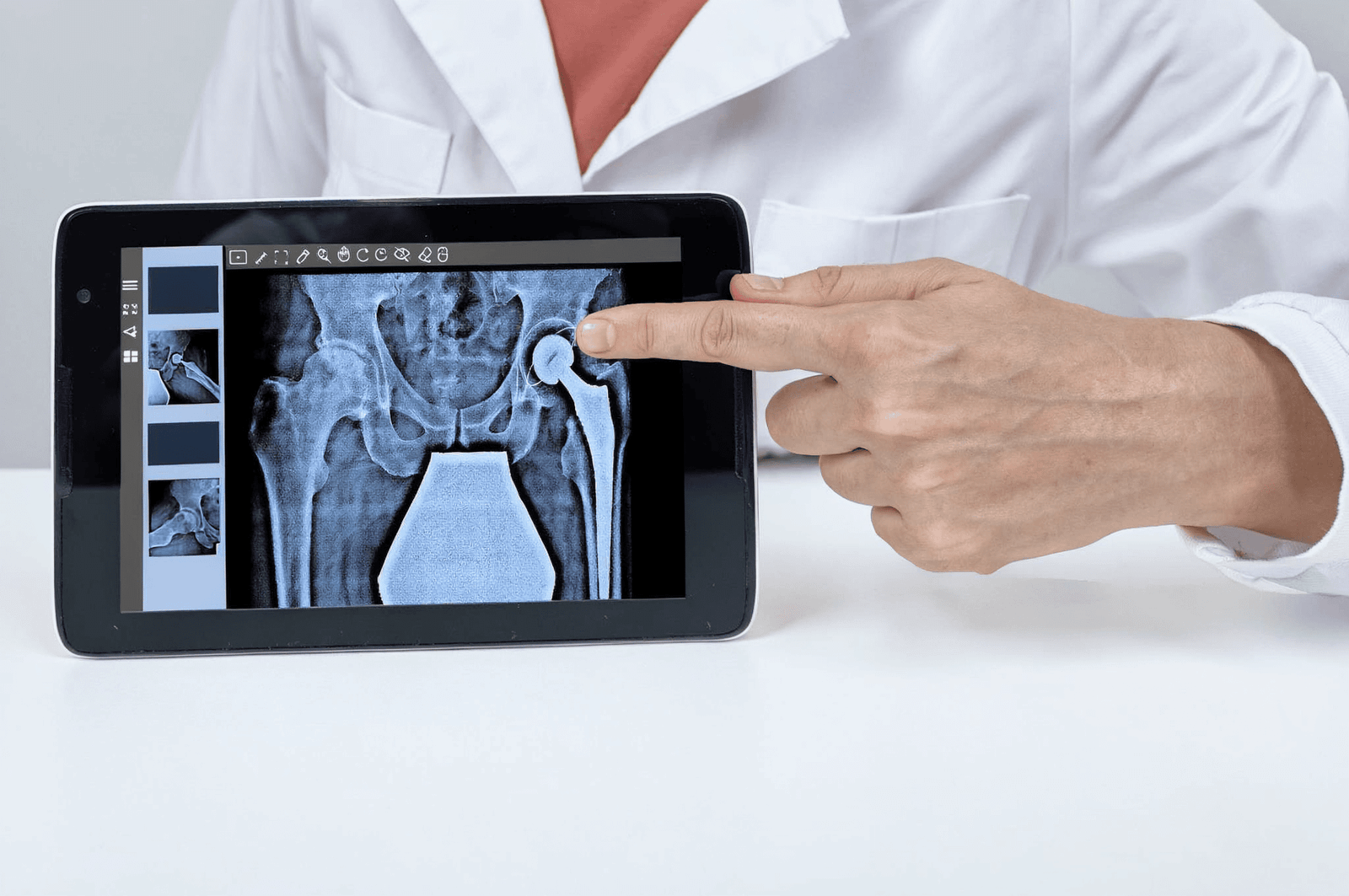 revision-hip-replacement